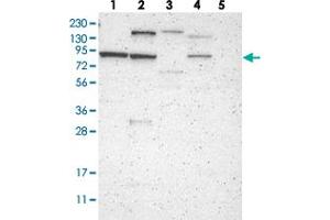 Western blot analysis of Lane 1: RT-4, Lane 2: U-251 MG, Lane 3: Human Plasma, Lane 4: Liver, Lane 5: Tonsil with C1orf71 polyclonal antibody . (CNST anticorps)
