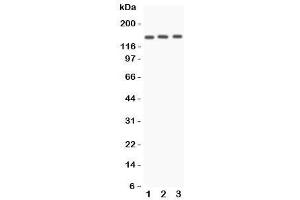 Western blot testing of Angiotensin Converting Enzyme antibody and Lane 1:  A549