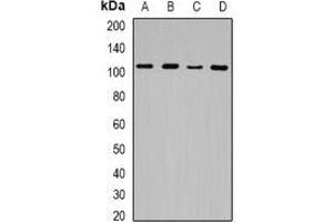 Western blot analysis of JHDM1D expression in Hela (A), HEK293T (B), mouse spleen (C), rat brain (D) whole cell lysates. (JHDM1D anticorps)