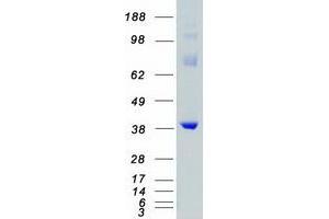Validation with Western Blot