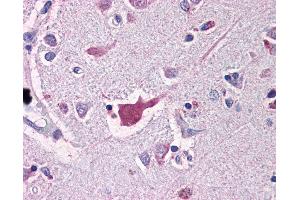 Anti-NALP2 antibody IHC of human brain, cortex.