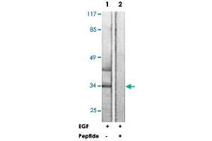 Western blot analysis of extracts from HUVEC cells, treated with EGF (200 ng/ml, 5 mins), using HNRNPC polyclonal antibody . (HNRNPC anticorps  (Ser260))