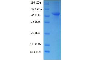 SDS-PAGE (SDS) image for Ribokinase (RBKS) (AA 2-322) protein (His-SUMO Tag) (ABIN5710217)