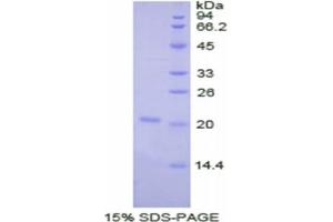 SDS-PAGE of Protein Standard from the Kit (Highly purified E.
