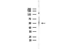 anti-Peripherin (PRPH) (C-Term) antibody