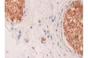 Detection of HBd in Human Stomach Tissue using Polyclonal Antibody to Hemoglobin Delta (HBd)