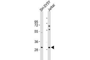 All lanes : Anti-TRMT61A Antibody (N-term) at 1:1000 dilution Lane 1: SH-SY5Y whole cell lysates Lane 2: Jurkat whole cell lysates Lysates/proteins at 20 μg per lane.