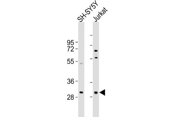 TRMT61A anticorps  (N-Term)