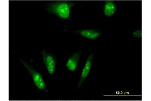 Immunofluorescence of monoclonal antibody to TAF7L on HeLa cell. (TAF7L anticorps  (AA 231-332))