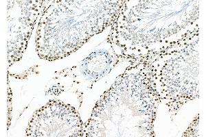 ABIN6259030 and ABIN6273465 at 1/100 staining Rat testis tissue by IHC-P. (APITD1 anticorps  (C-Term))