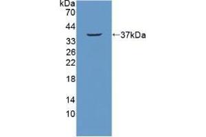 Western blot analysis of recombinant Mouse NUP214. (NUP214 anticorps  (AA 601-868))