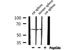 Western blot analysis of extracts from rat spleen,mouse spleen, using Cytochrome P450 2D6 Antibody. (CYP2D6 anticorps)