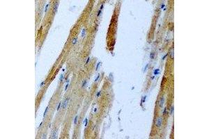 Immunohistochemical analysis of GnT-III staining in rat heart formalin fixed paraffin embedded tissue section. (MGAT3 anticorps)