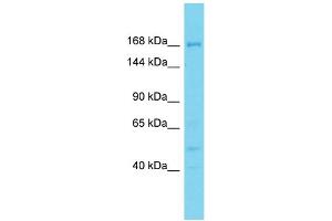 Host: Rabbit Target Name: DDX60L Sample Type: PANC1 Whole Cell lysates Antibody Dilution: 1. (DDX60L anticorps  (N-Term))