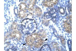 anti-Tripartite Motif Containing 15 (TRIM15) (AA 141-190) antibody