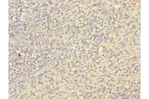 Immunohistochemistry of paraffin-embedded human spleen tissue using ABIN7172018 at dilution of 1:100 (TXNRD1 anticorps  (AA 1-497))