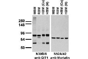 Immunoblots on brain membranes prepared from whole rat (RBM) and mouse (MBM) brain, and from human cerebral cortex [HBM(Cx)] and hippocampus [HBM(H)].
