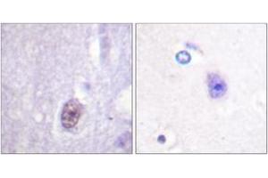 Immunohistochemistry analysis of paraffin-embedded human brain, using SP1 (Phospho-Thr453) Antibody.