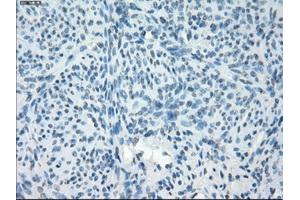 Immunohistochemical staining of paraffin-embedded endometrium tissue using anti-PDE10A mouse monoclonal antibody. (PDE10A anticorps)