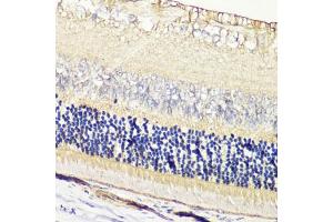 Immunohistochemistry of paraffin-embedded rat retina using GRK1 antibody  at dilution of 1:200 (40x lens). (GRK1 anticorps  (AA 1-160))