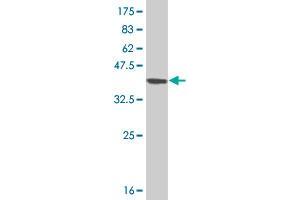 Western Blot detection against Immunogen (37.