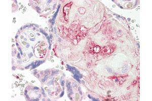 Anti-P2Y1 antibody IHC of human placenta.