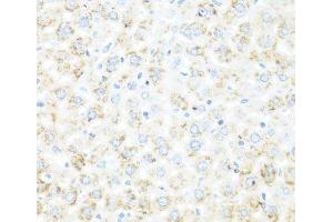 Immunohistochemistry of paraffin-embedded Mouse liver using IL7 Polyclonal Antibody at dilution of 1:100 (40x lens).