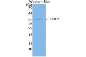 Western Blotting (WB) image for anti-Integrin beta 3 (ITGB3) (AA 135-377) antibody (ABIN1174439)