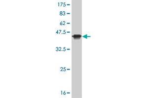Western Blot detection against Immunogen (36. (KAT2B anticorps  (AA 353-452))