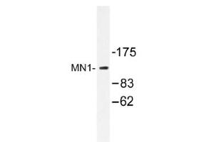 Image no. 1 for anti-MN1 proto-oncogene (MN1) antibody (ABIN317611) (Meningioma 1 anticorps)