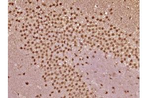 Paraformaldehyde-fixed, paraffin embedded Mouse brain Antigen retrieval by boiling in sodium citrate buffer (pH6.