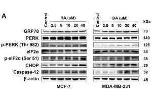 MCF-7 and MDA-MB-231 cells were treated with the indicated concentrations of BA for 24 h, and the protein levels of ER stress-associated signals were stimulated by BA in a dose-dependent manner, including GRP78, p-PERK/PERK, p-eIF2α/eIF2α, CHOP, and caspase-12. (EIF2S1 anticorps  (pSer51))