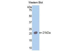 Western Blotting (WB) image for anti-Interleukin 18 Receptor 1 (IL18R1) (AA 391-518) antibody (ABIN1859373)