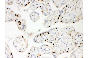 Anti- PARP Picoband antibody, IHC(P) IHC(P): Human Placenta Tissue