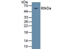 Detection of Recombinant CDSN, Human using Polyclonal Antibody to Corneodesmosin (CDSN) (Corneodesmosin anticorps  (AA 33-300))