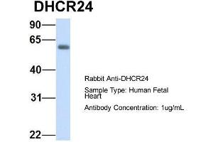 Host:  Rabbit  Target Name:  DHCR24  Sample Type:  Human Fetal Heart  Antibody Dilution:  1. (Seladin 1 anticorps  (N-Term))