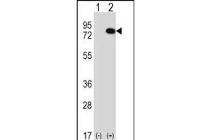 Western blot analysis of RIOK1 (arrow) using rabbit polyclonal RIOK1 Antibody (N-term) (ABIN391301 and ABIN2841337).