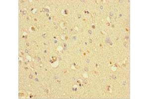 Immunohistochemistry of paraffin-embedded human brain tissue using ABIN7148316 at dilution of 1:100 (COMMD6 anticorps  (AA 1-85))
