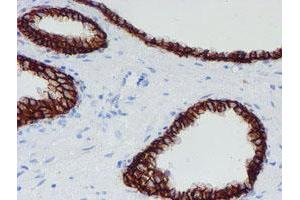 Image no. 10 for anti-Signal Recognition Particle Receptor, B Subunit (SRPRB) antibody (ABIN1501126)