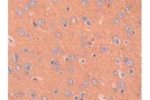 DAB staining on IHC-P; Samples: Rat Cerebrum Tissue (CCL4 anticorps  (AA 24-92))
