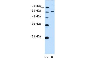 WB Suggested Anti-BMP2K Antibody Titration:  5. (BMP2K anticorps  (C-Term))