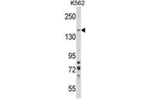 Western blot analysis of SORCS1 Antibody (N-term) in K562 cell line lysates (35ug/lane). (SORCS1 anticorps  (N-Term))