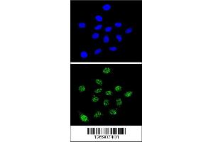 Confocal immunofluorescent analysis of DKC1 Antibody with 293 cell followed by Alexa Fluor 488-conjugated goat anti-rabbit lgG (green). (DKC1 anticorps  (AA 185-213))