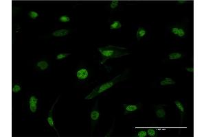 Immunofluorescence of monoclonal antibody to HNRNPM on HeLa cell.