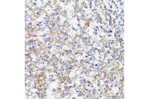 Immunohistochemistry of paraffin-embedded Human tonsil using CD276/B7-H3 antibody (ABIN7266182) at dilution of 1:100 (40x lens).