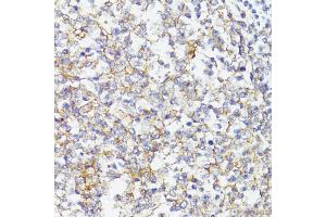 Immunohistochemistry of paraffin-embedded Human tonsil using CD276/B7-H3 antibody (ABIN7266182) at dilution of 1:100 (40x lens). (CD276 anticorps  (AA 100-200))