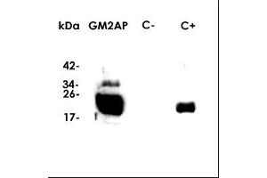 Western-Blot (Dilution 1:1000 in PBS) , kDA: molecular weight marker , GM2AP: recomb. (GM2A anticorps  (Isoform 1))