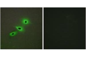 Immunofluorescence analysis of A549 cells, using Cytochrome P450 19A1 Antibody. (Aromatase anticorps  (AA 221-270))