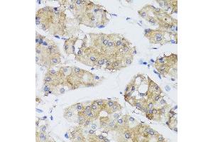 Immunohistochemistry of paraffin-embedded human gastric using FGF13 antibody at dilution of 1:100 (x40 lens). (FGF13 anticorps)