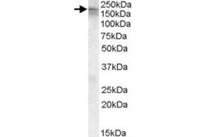 CACNA1C polyclonal antibody  (0. (CACNA1C anticorps)